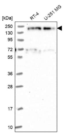EDC4 Antibody, Novus Biologicals 0.1mL; Unlabeled:Antibodies, Polyclonal